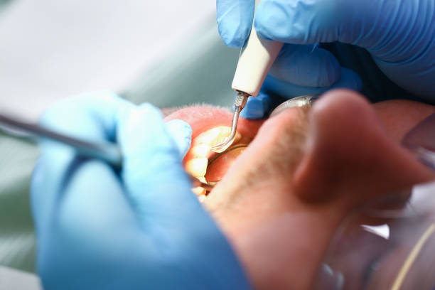 Best Walk-In Emergency Dentist in Colleyville, TX
