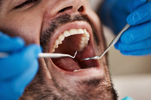 Best Emergency Dental Surgery in Colleyville, TX