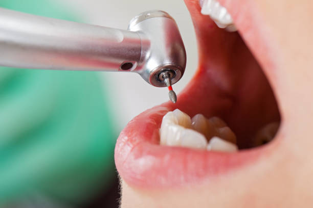 Best Weekend Emergency Dentist in Colleyville, TX